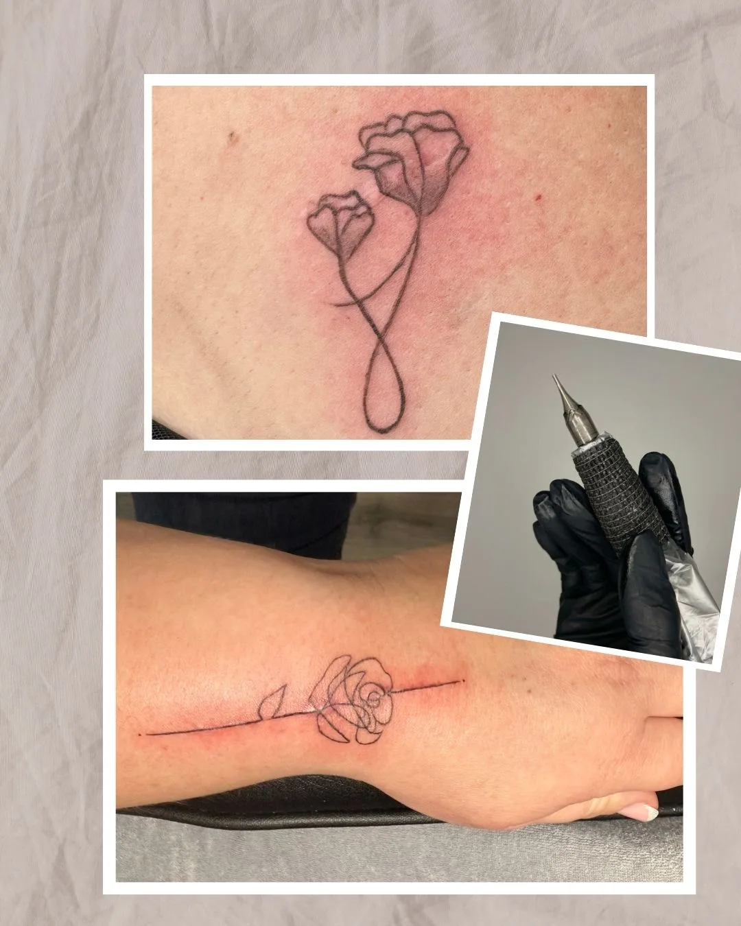 Tatouage sur cicatrice - Tatouage artistique thérapeutique Vendée - SabyDermoBeauty
